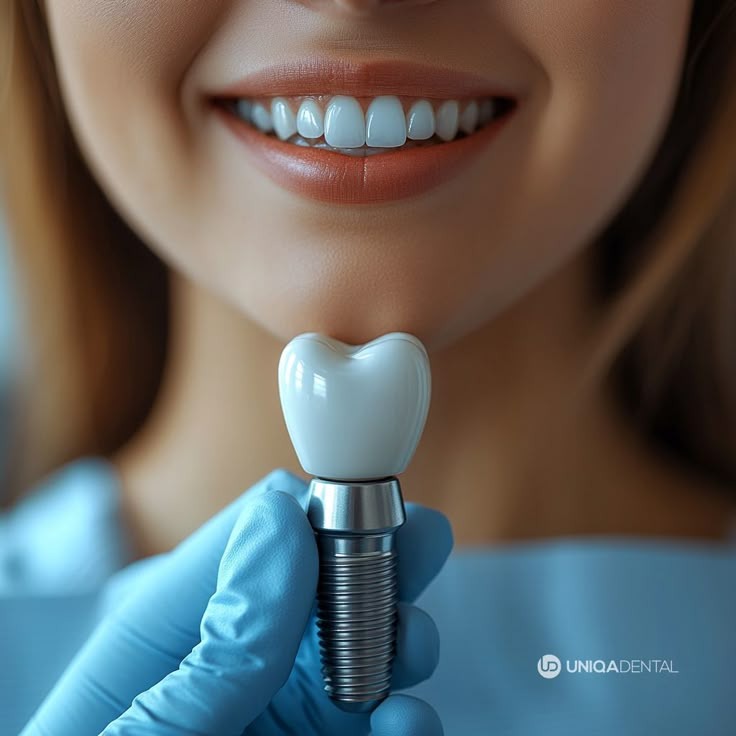 Best Dentist for Dental Implants in Islamabad | Dr. Usama Hayat Ghauri